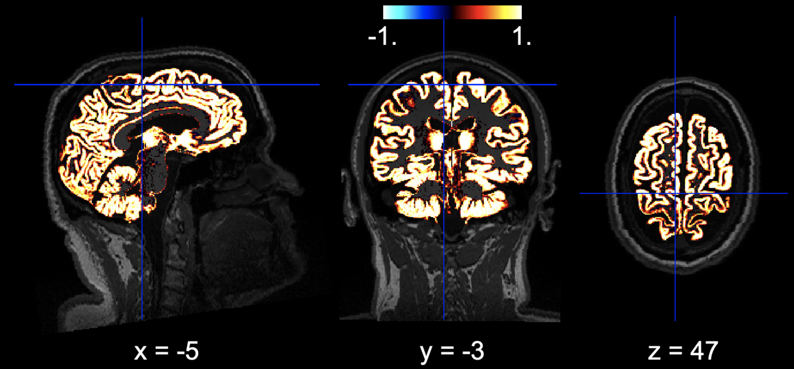 Brain Volume Analysis