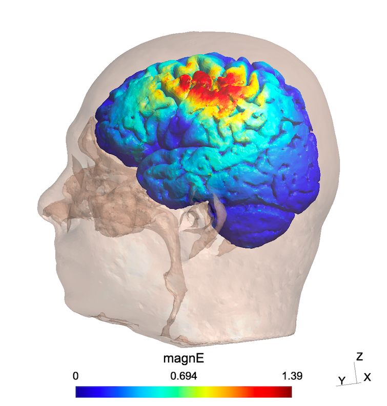 E-Field Simulation Image